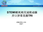 [IHF2009]STEMI梗死相关血管开口异常经桡动脉直接PCI